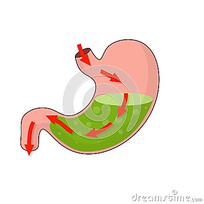 Stomach and rout of pill. Dissolving drug. Disease of human internal organ. Cartoon flat illustration Vector Illustration