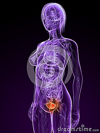 Bladder cancer Cartoon Illustration