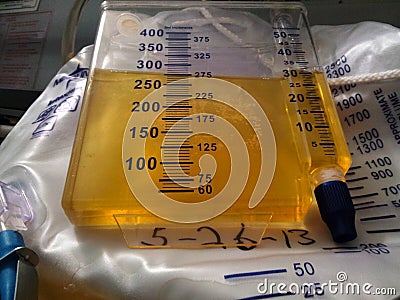 Bladder catheter reservoir filled with yellow urine Stock Photo