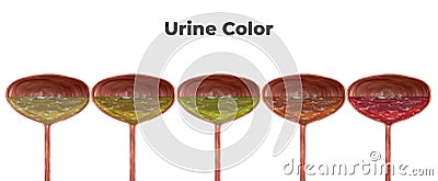 Bladder isolated on white background with urine color grading. Urine staining helps in the diagnosis of urinary tract diseases Stock Photo