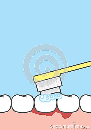 Blank banner Bleeding when brushing illustration vector on blue background. Dental concept Vector Illustration