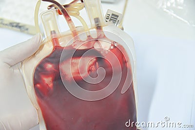 Blood bag in laboratory Stock Photo