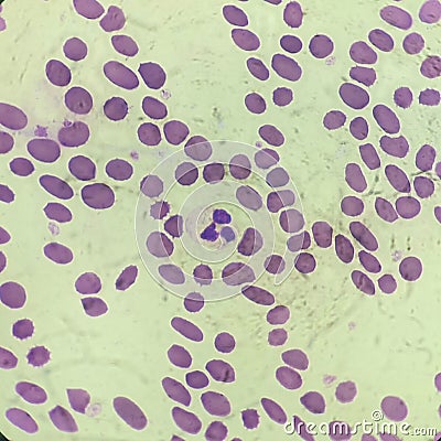 Blood cell in Giemsa stain Stock Photo