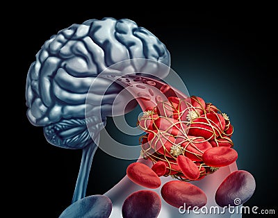 Blood Clot Brain Cartoon Illustration