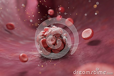 Blood clot and red blood cells in artery Cartoon Illustration