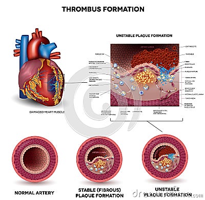 Blood clot formation Vector Illustration