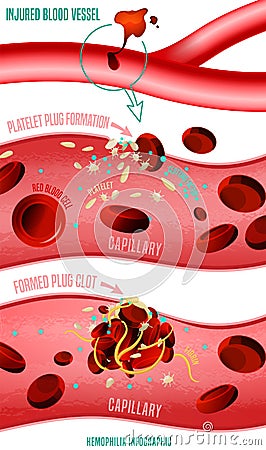 Blood clot formation Vector Illustration