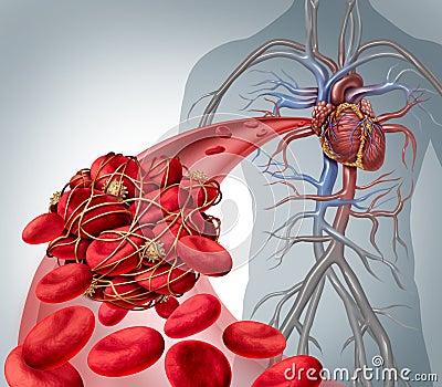 Blood Clot Risk Cartoon Illustration