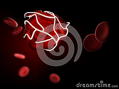 Blood clot and thrombosis, medical 3d illustration concept a health disorder. Cartoon Illustration