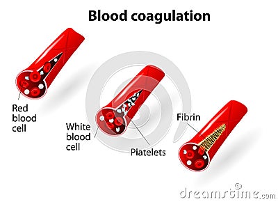 Blood coagulation Vector Illustration