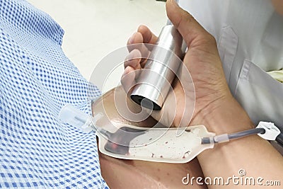 Blood donor at donation with a bouncy ball holding in hand Stock Photo