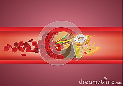 Blood flow blocked from fast food which have high fat and cholesterol. Vector Illustration