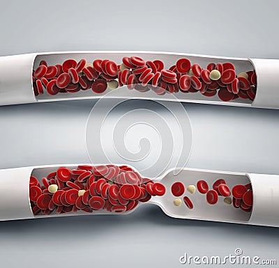 Blood flowing and blood clot Stock Photo