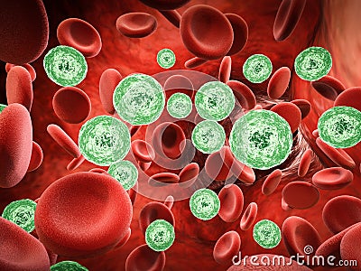 Blood infection with bacteria and virus cells Stock Photo