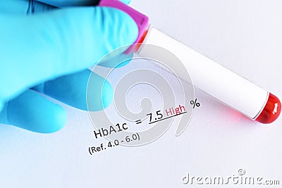 Abnormal high HbA1c test result Stock Photo