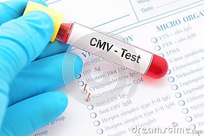 CMV test Stock Photo