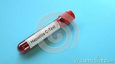 Hepatitis-C virus test Stock Photo