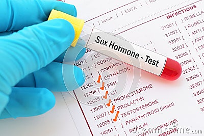 Sex hormone test Stock Photo