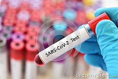 Blood sample for SARS-CoV-2 Stock Photo