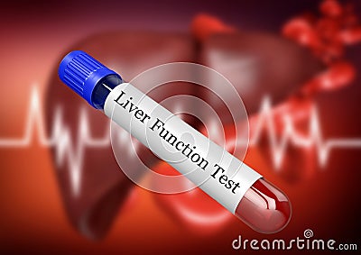 Blood sample in test tube for examination of liver function in laboratory Stock Photo