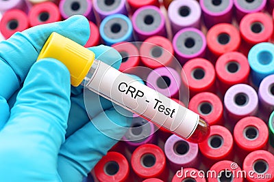 C-reactive protein test Stock Photo