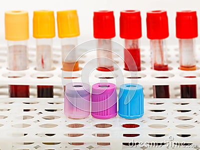 Blood sample tubes Stock Photo