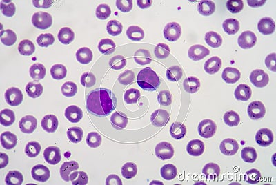 Blood smear Stock Photo