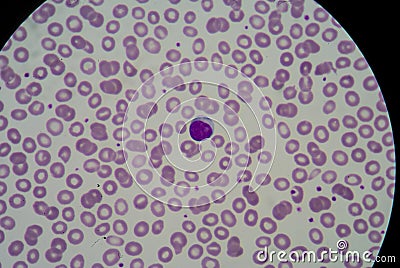 Blood smear Stock Photo