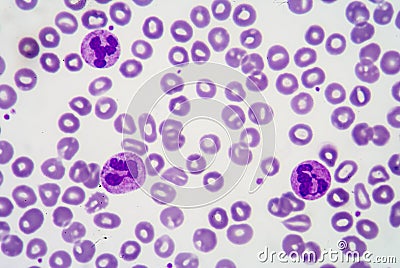 Blood smear Stock Photo