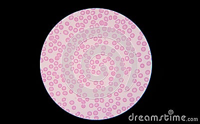 Blood smear under microscope is showing normal red blood cell. Stock Photo