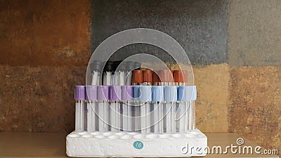 Blood specimen tubes Stock Photo