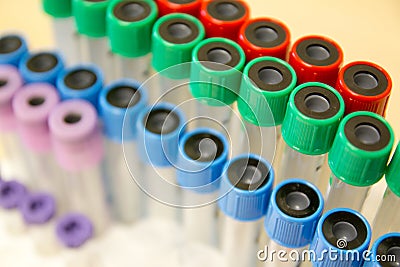 Blood specimen tubes Stock Photo