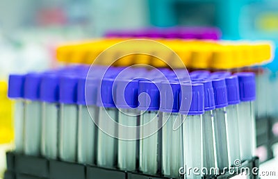 Blood specimen tubes on the tray. Stock Photo