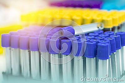 Blood specimen tubes on the tray in the hospital. Stock Photo