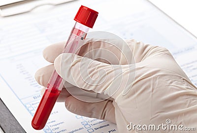 Blood test Stock Photo