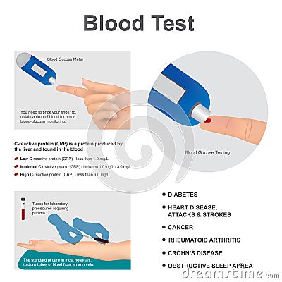 Blood test laboratory analysis. Illustration graphic vector. Stock Photo