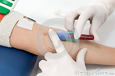 Blood test from vein Stock Photo