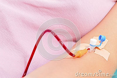 Blood transfusion Stock Photo