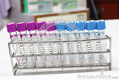 Blood tube test for analysis in the laboratory of haematology / Stock Photo