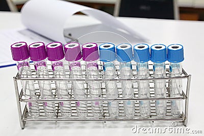Blood tube test for analysis in the laboratory of haematology / Stock Photo