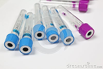 Blood tube test for analysis in the laboratory of haematology / Stock Photo