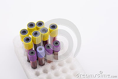 Blood tubes, medical sector, test tube Stock Photo