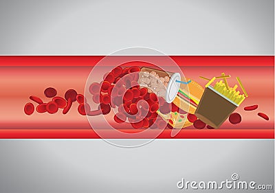 Blood vessel is blocked by hamburger and fast food. Vector Illustration