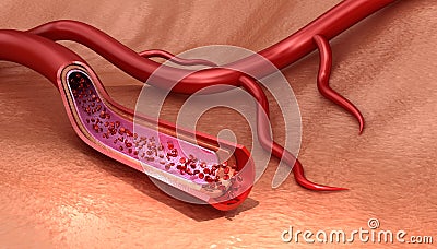 Blood vessel sliced macro with erythrocytes , Medically accurate illustration Cartoon Illustration