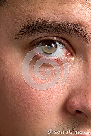 Bloodshot Eye Stock Photo