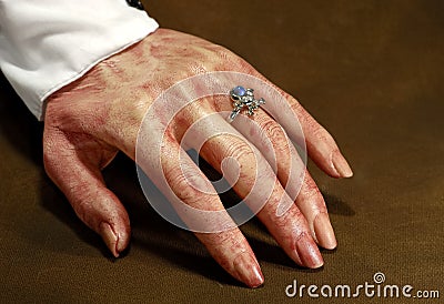 Bloody Hand Stock Photo