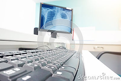 Blurred closeup the keyboard taking the chest x-ray .result to the patient Stock Photo