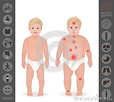 Body of a child, thick and thin , pain points, detailed vector i Vector Illustration