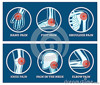 Body Pain. Icons Set. Pain in Hand, Knee, Neck, Elbow, Foot and Shoulder Stock Photo