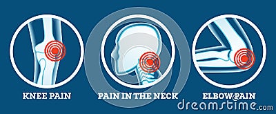 Body Pain. Icons Set. Pain in Knee, Neck and Elbow. Woman`s and Man`s Body Parts Stock Photo